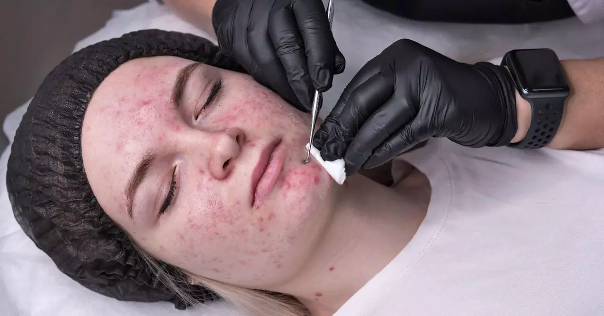 60 Min. Gesichtsbehandlung mit Tiefenreinigung und optionaler Massage