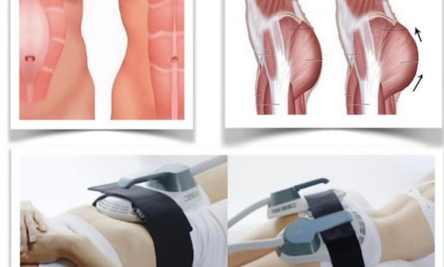 Image 1: Raffermissement par électrostimulation au Nobel Institut à Annemasse