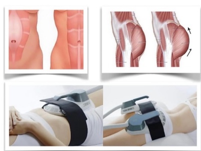 1 séance découverte de 30 min. de raffermissement musculaire par électrostimulation - réservé aux femmes - Nobel institut