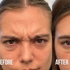 Image 3: Up to 65% Off on Injection - Botox at Nude Aesthetics