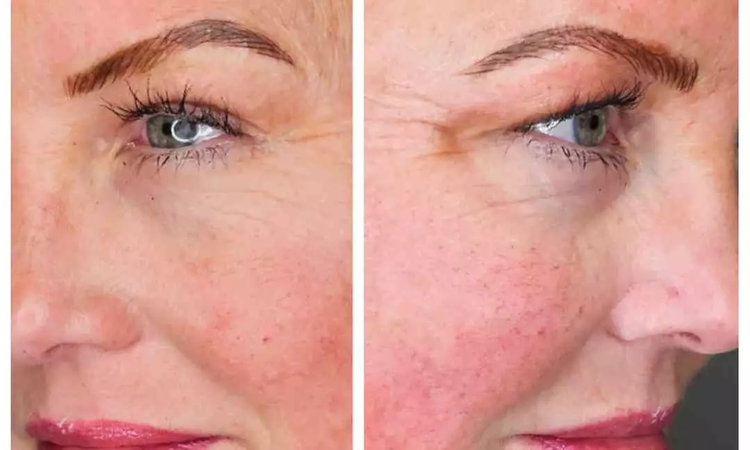 Perfect Brows with One Microblading Session with or without Touch-Up