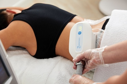 One area Fat Freezing/ Cryolipolisis Session - Fat freeze lab