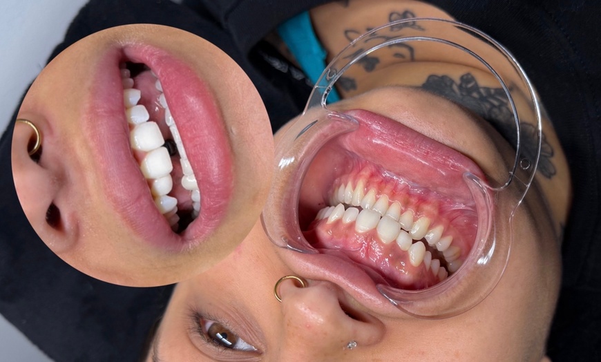 Image 4: Sublimez votre regard avec un rehaussement ou des extensions de cils