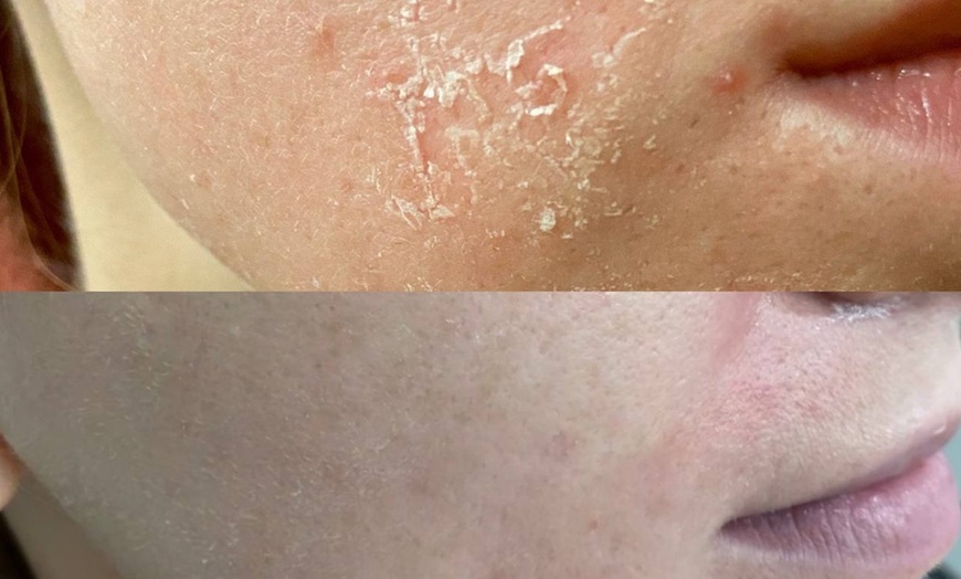 Image 4: Bis zu 56% Rabatt auf den Kosmetische Gesichtsbehandlung bei Gym for skin Kosmetiksalon