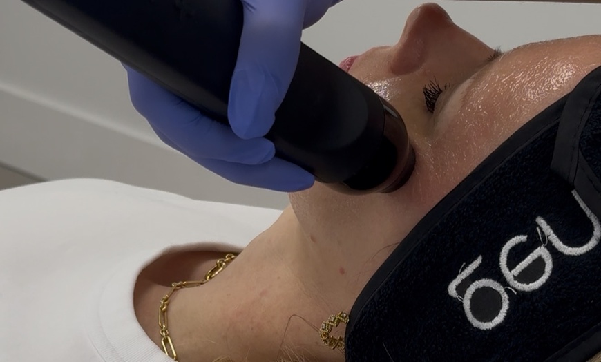 Image 1: Transform your Skin with Radio Frequency and Ultrasound