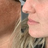 Image 4: Get Radiant Skin with 1, 2, or 3 IPL Sessions - 10 Minutes Per Session
