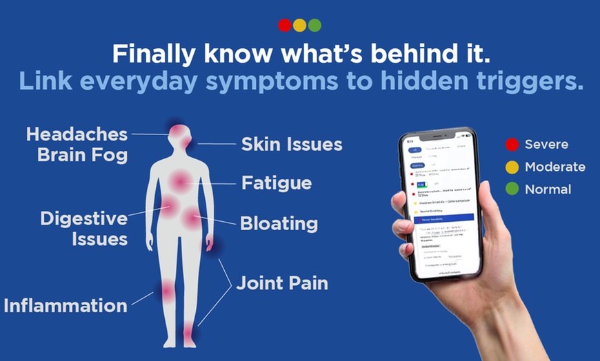Image 1: Up to 88% Off on Allergy/Food Intolerance Testing at Ucari