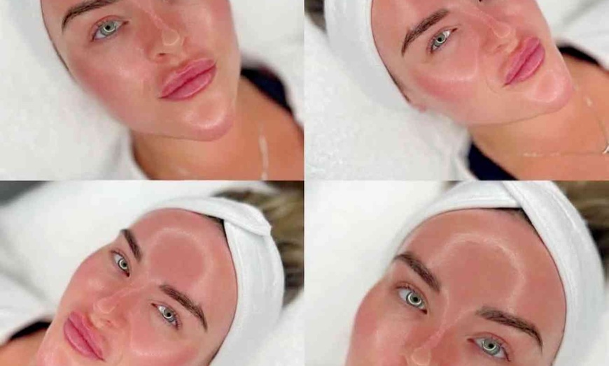 Image 3: Microdermabrasion & Medical-Grade Brightening Facial at LeLux Beautique