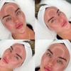 Image 3: Microdermabrasion & Medical-Grade Brightening Facial at LeLux Beautique
