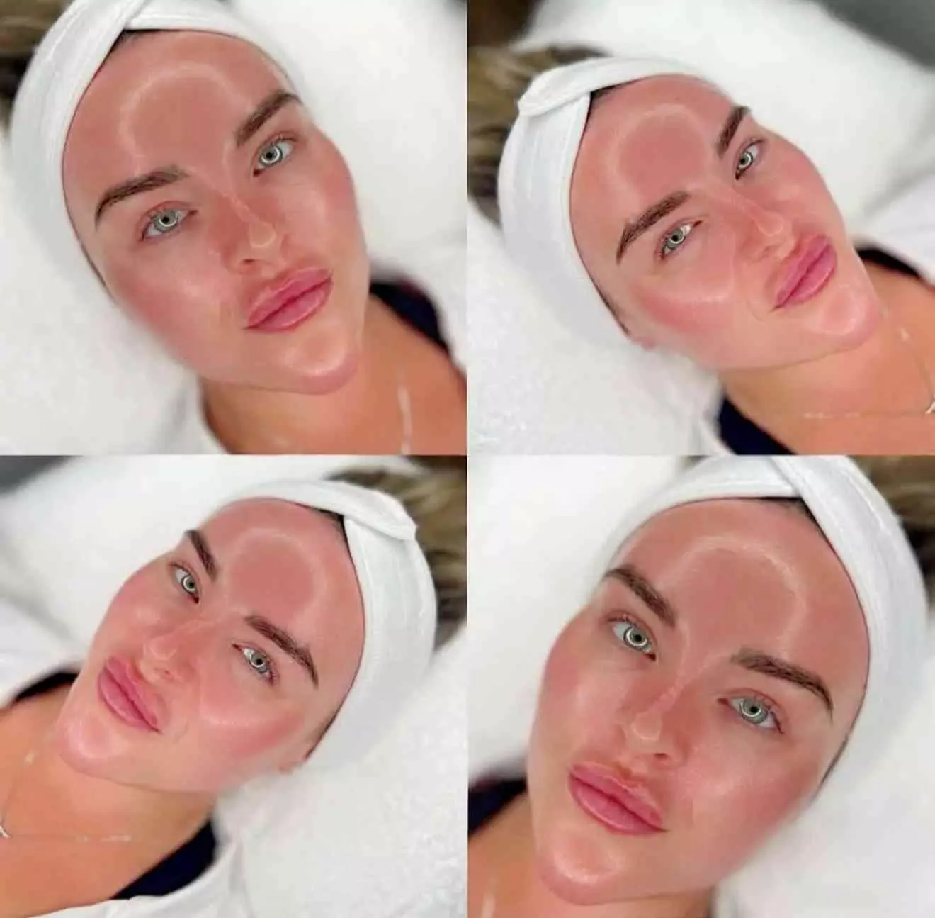 Microdermabrasion & Medical-Grade Brightening Facial at LeLux Beautique