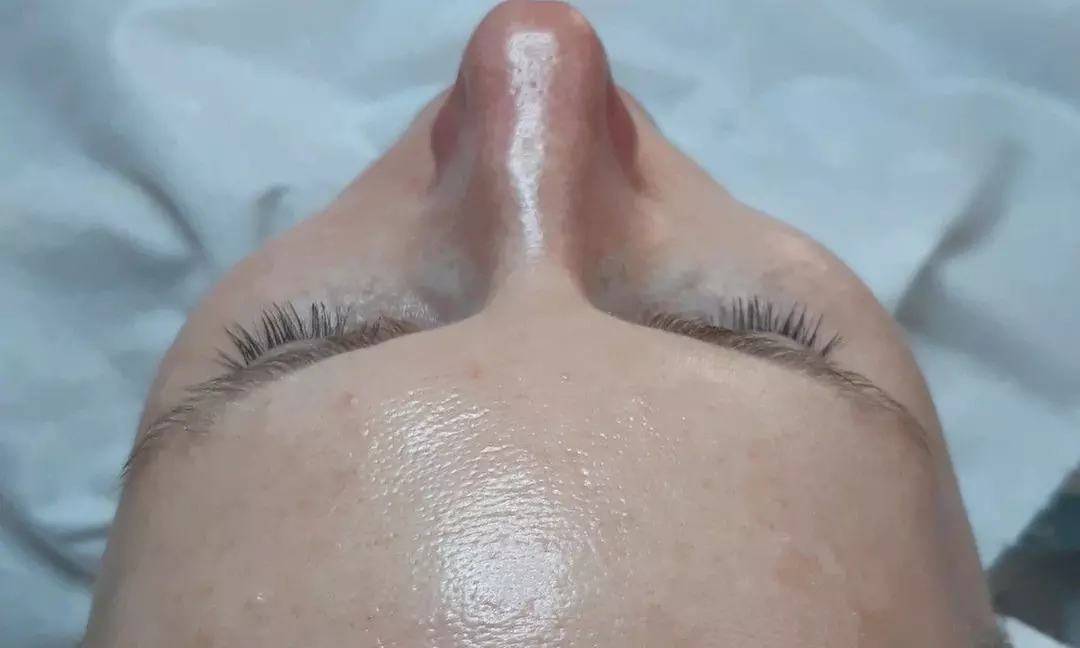 Do 30% zniżki na Zabieg na twarz - pielęgnacja porów w ProEstetik Gabinet Kosmetologii - Second Medium