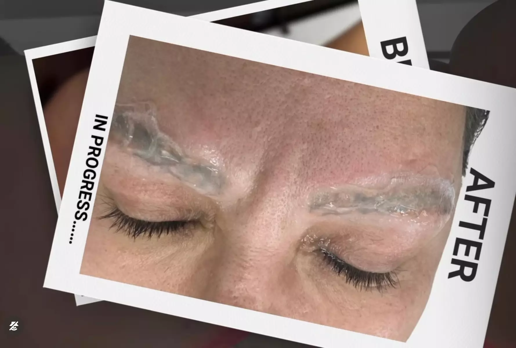 Up to 65% Off on Tattoo Removal at The Body Lux