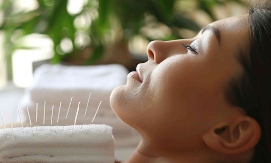 Image 1: Up to 30% Off on Acupuncture at Point Power Acupuncture