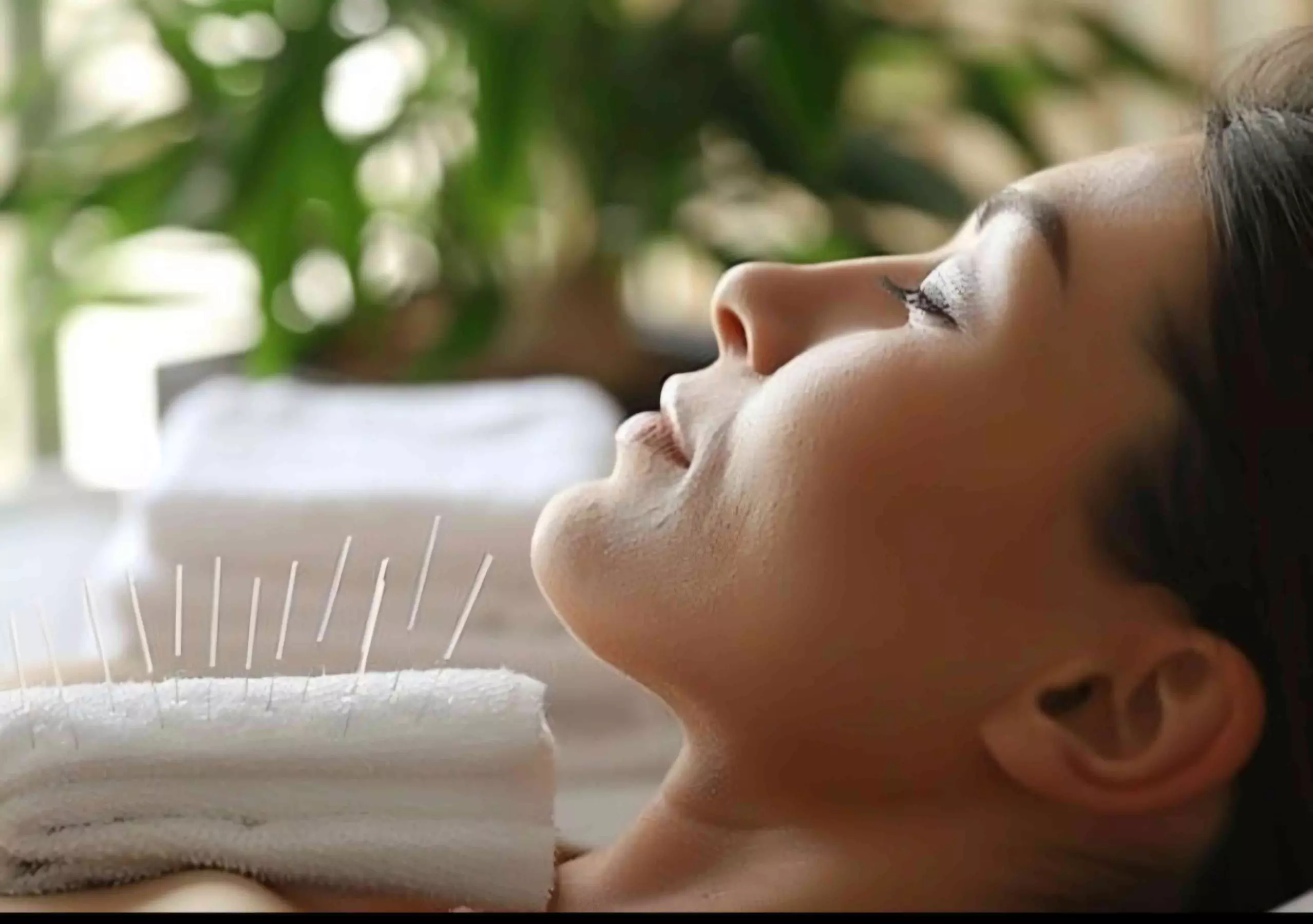 Up to 46% Off on Acupuncture at Point Power Acupuncture and Wellness