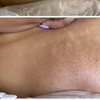 Image 1: Waxing Packages: One or Ten Brazilian/Bikini Wax Treatments