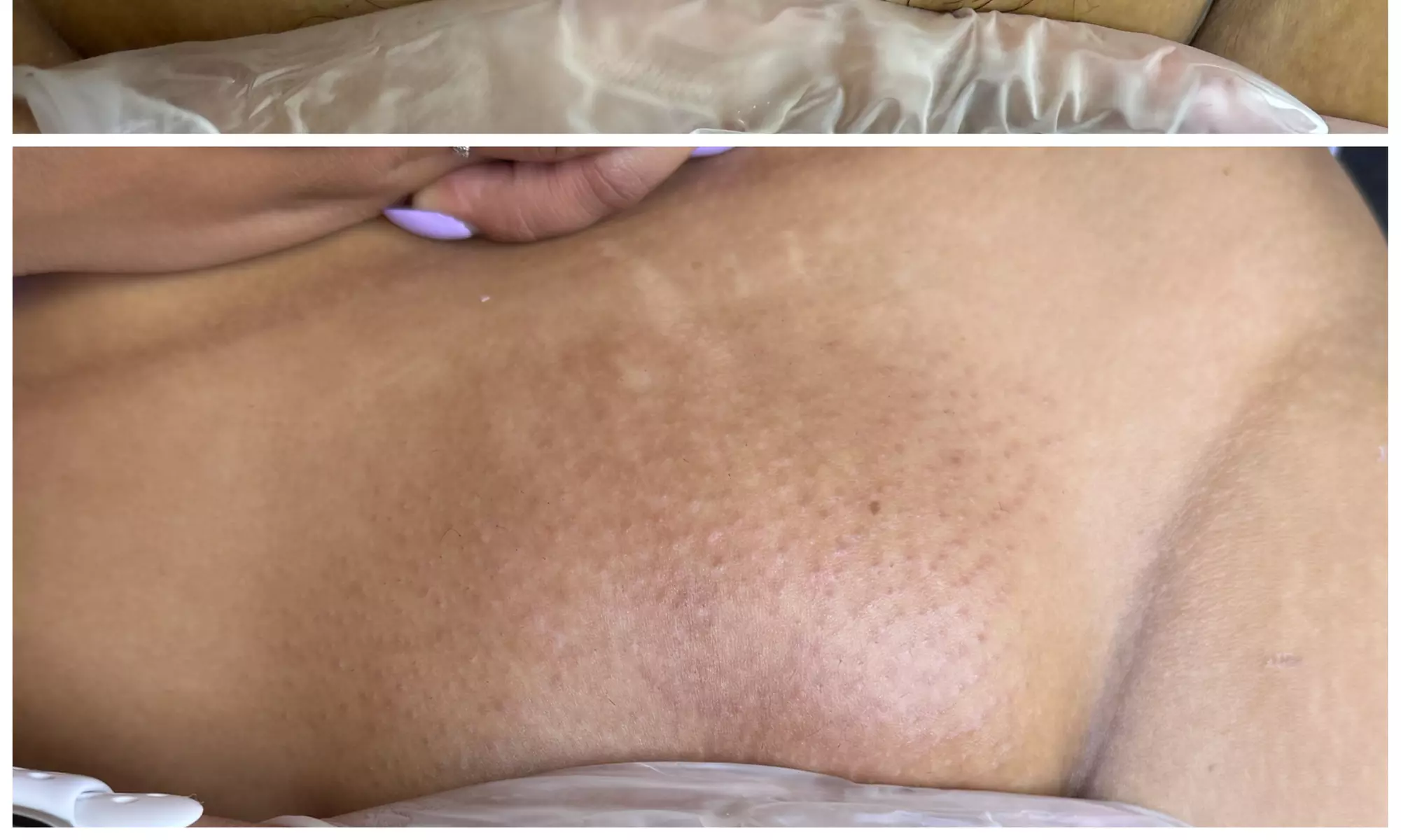 Waxing Packages: One or Ten Brazilian/Bikini Wax Treatments