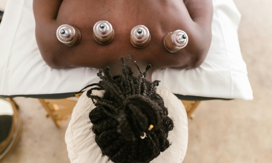 Image 2: Up to 80% Off on Acupuncture and Cupping at Core Meridian