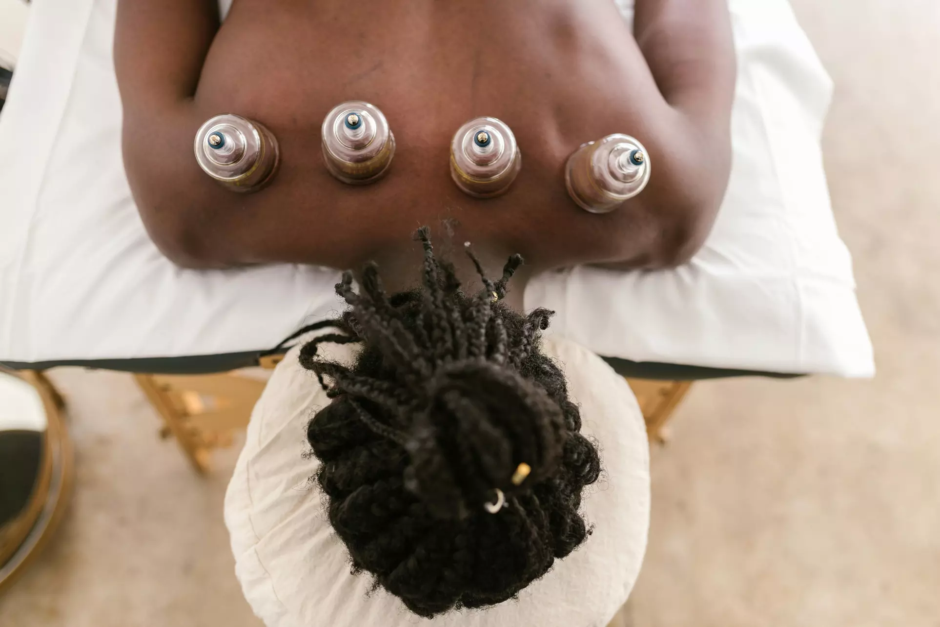 Up to 72% Off on Acupuncture at Core Meridian Acupuncture