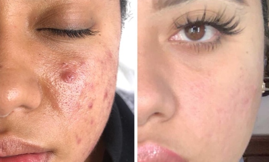 Image 9: Relaxing Facial & Massage or Holistic Body Contour & Wrap Treatment