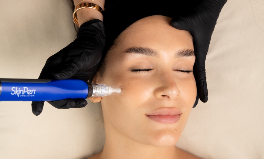 Image 2: Up to 40% Off on Vampire Facelift at JENNVIE Med Spa