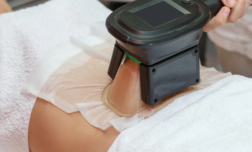 Image 1: Technologie die je leven makkelijker maakt: cryolipolyse behandeling
