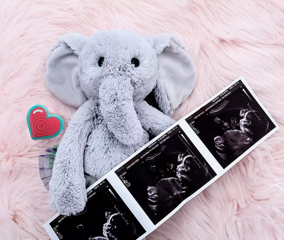 Up to 30% Off on Ultrasound - 3D / 4D at 3D Maternity Imaging