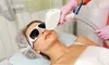 Revitalize Your Skin with One or Two IPL Treatments at Prime Med Spa & Plastic Surgery (Up to 67% Off)