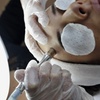 Image 3: One or Three Sessions of Diamond Dermabrasion Skin Peeling Sessions