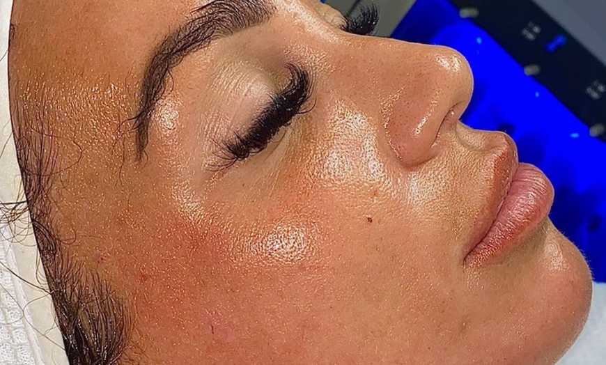 Image 2: Facial - HydraFacial at Lash hq ltd