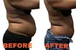 Up to 50% Off on Cavitation at Contoured Curves by Shereen llc - Second Medium