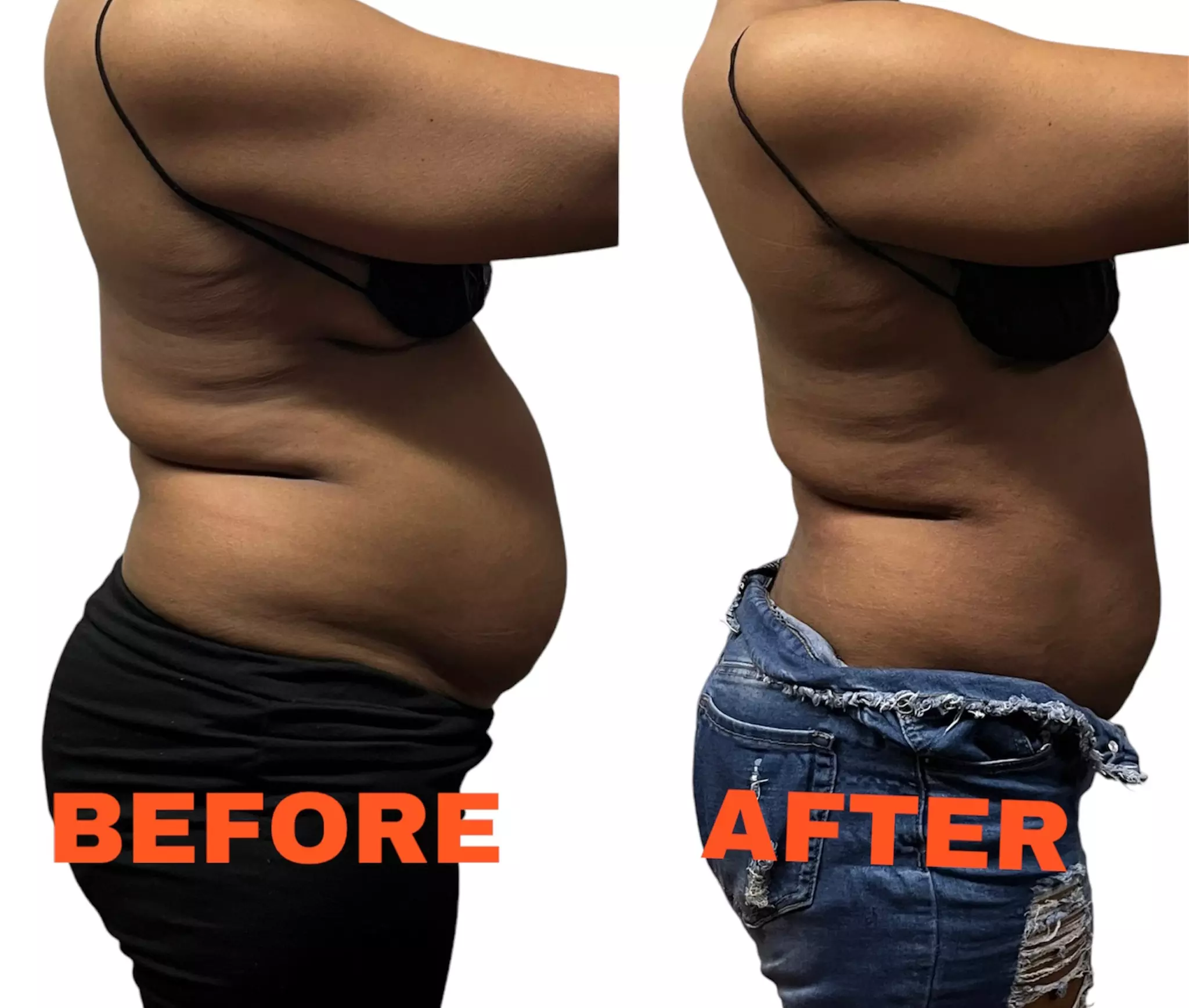 Up to 50% Off on Cavitation at Contoured Curves by Shereen llc