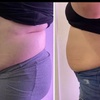 Image 4: Up to 62% Off on Fat Reduction - Non-Branded at Beauty By Bear