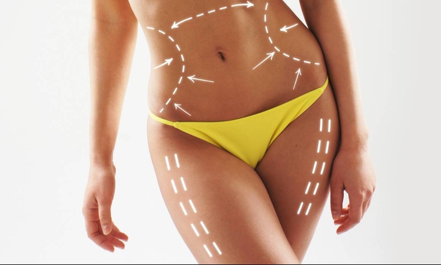 Image 3: Up to 65% Off on Injection Therapy at UK Aesthetics Lounge