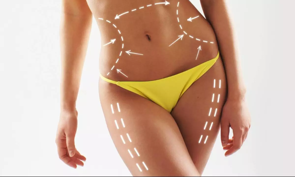 Up to 65% Off on Injection Therapy at UK Aesthetics Lounge