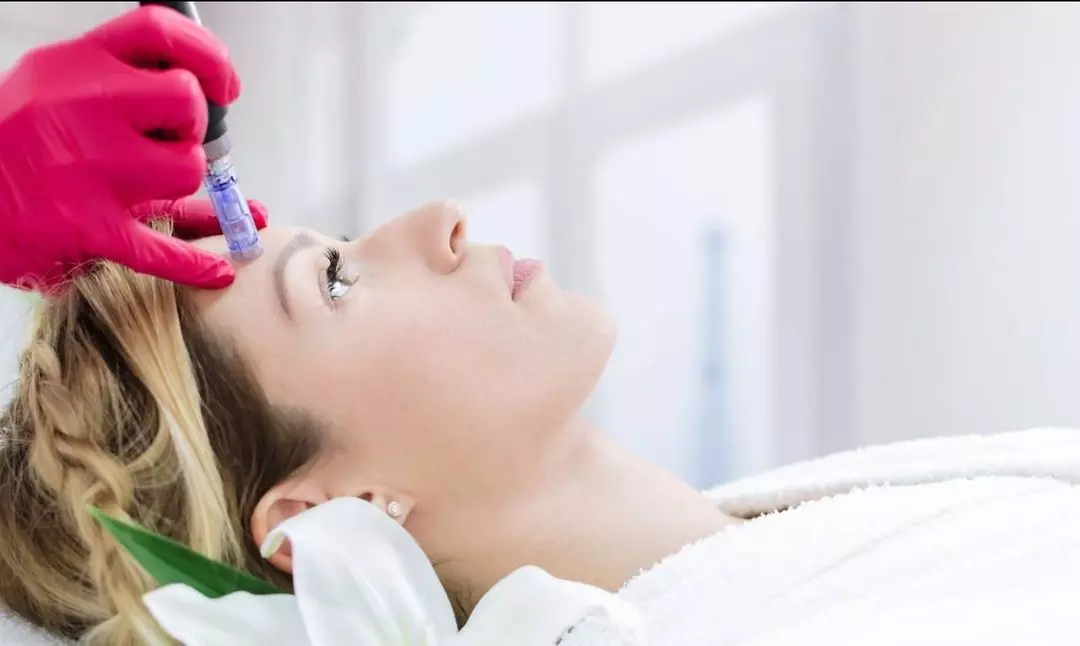 Up to 30% Off on Micro-Needling at Dermapure, LLC