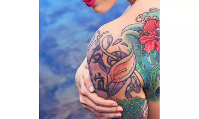 Uncover SOS Medical Aesthetics' Three or Five Laser Tattoo Removal Sessions up to 15 sq in & Save 89% Off