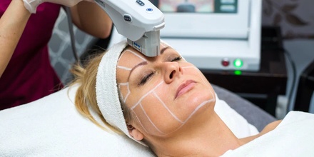 14D HIFU: Upper or Lower Face Skin Tightening (New Clients Only) - Forever YOU Dermal Clinic