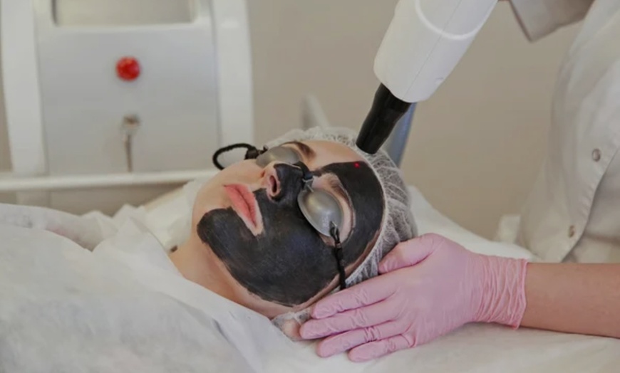 Image 3: Soin du visage lifting coréen au fil de soie sur 1 ou 2 zones