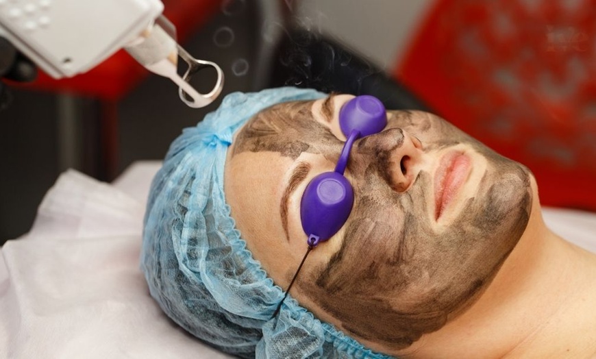Image 2: Carbon Laser Peel with Deep Pore Cleansing and Instant Glow