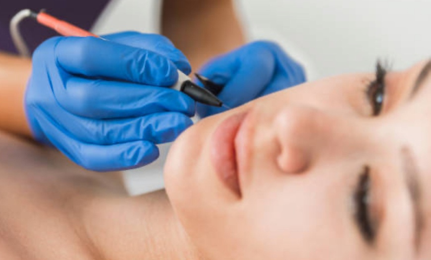 Image 1: Experience Smoothness with Electrolysis Consultation & 15 mins Session