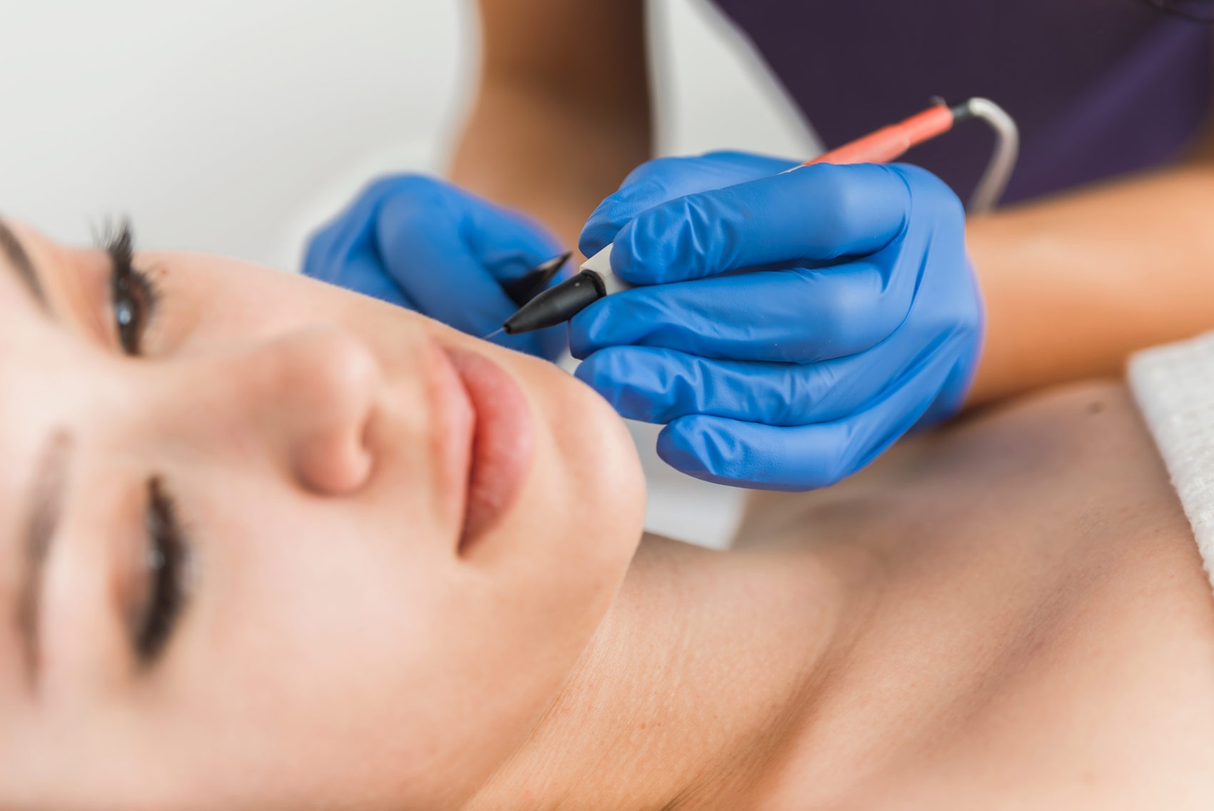 Get Smooth Skin with 30-Minute Electrolysis Sessions