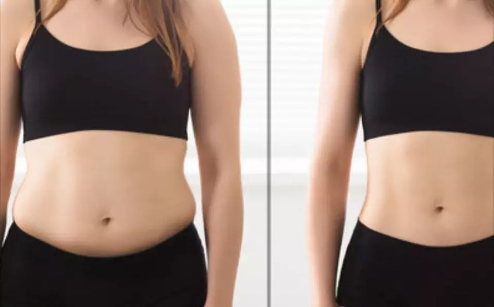 Up to 55% Off on Lipo - Non-Invasive Laser-iLipo at Body Sculpture by Carmen