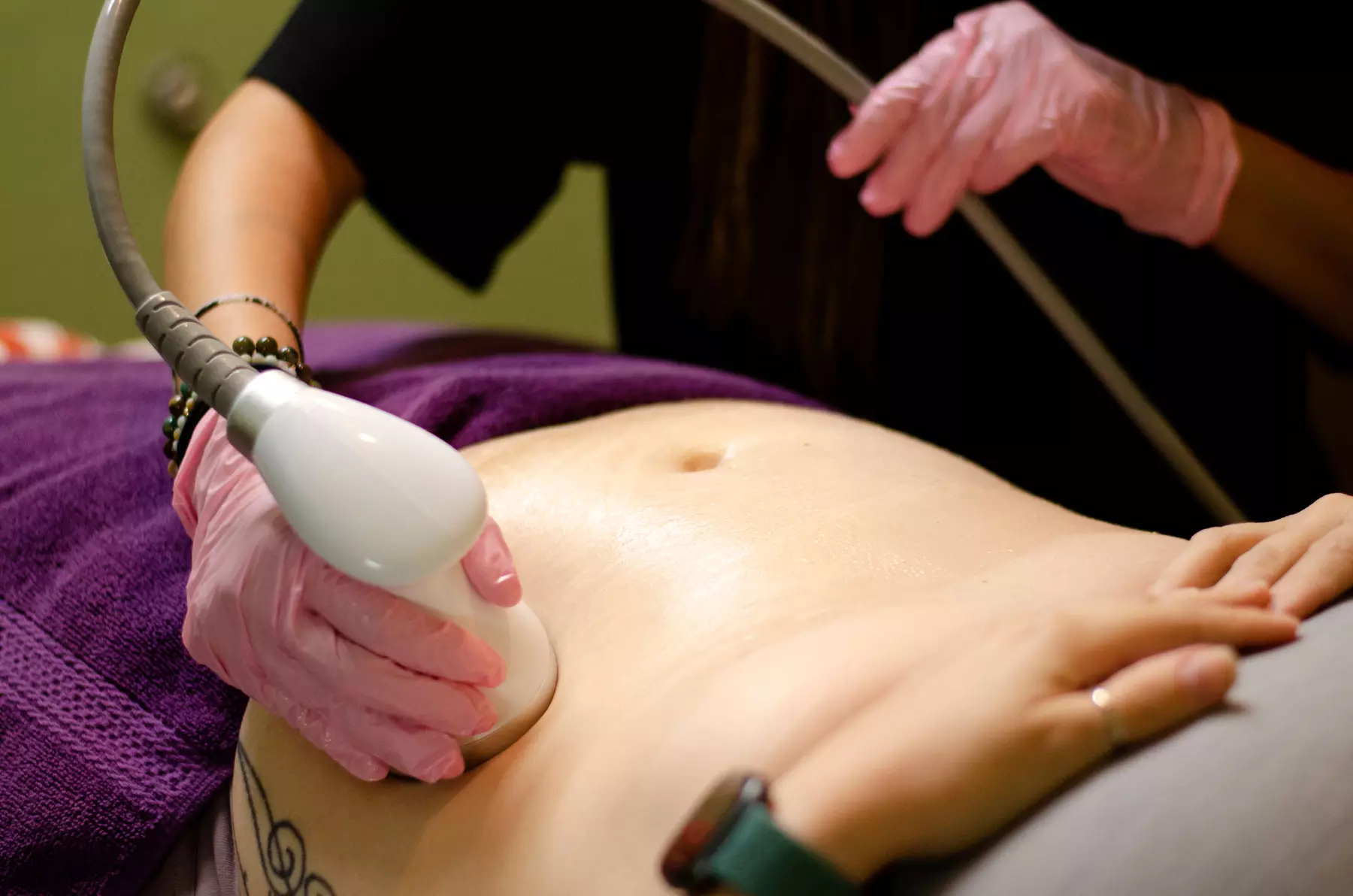 Up to 30% Off on Radio Frequency Skin Tightening at Upkeep Living