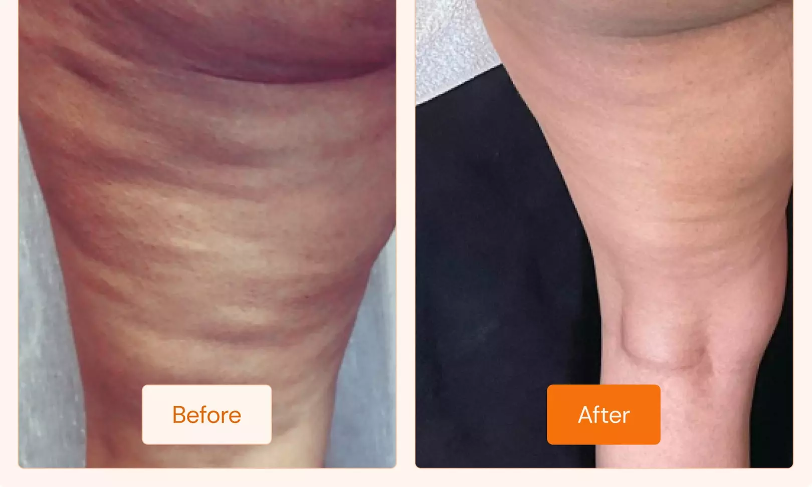 Cryotherapy Sprays & Massage: 1, 3, or 5 Session Wellness Boost
