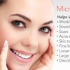 Image 3: Up to 53% Off on Micro-Needling at My Aesthetic Lounge