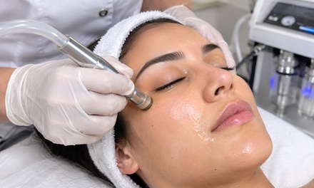One Microdermabrasion Treatment - Art Of Threading Salon