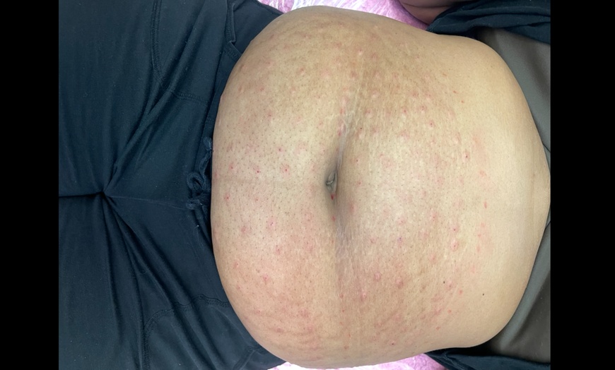 Image 4: Fat Dissolver at Pamper Me Pretty Day Spa