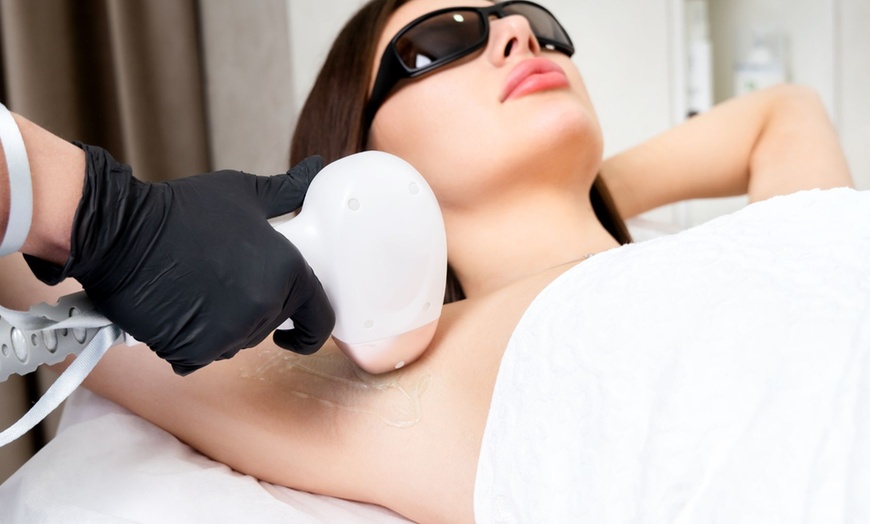 Image 1: Up to 50% Off on Laser Hair Removal at Modern Wellness & Beauty