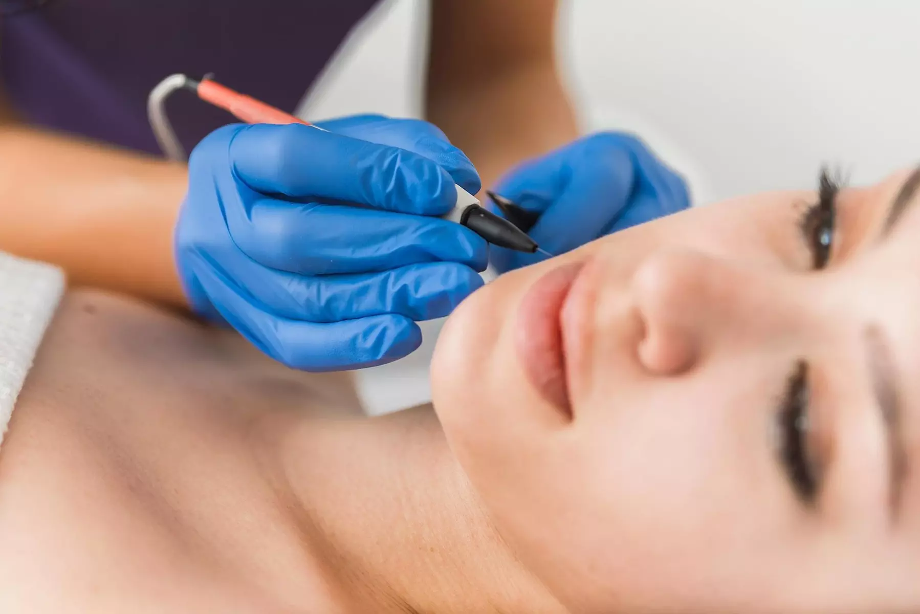 Up to 51% Off on Electrolysis at True Electrology, LLC