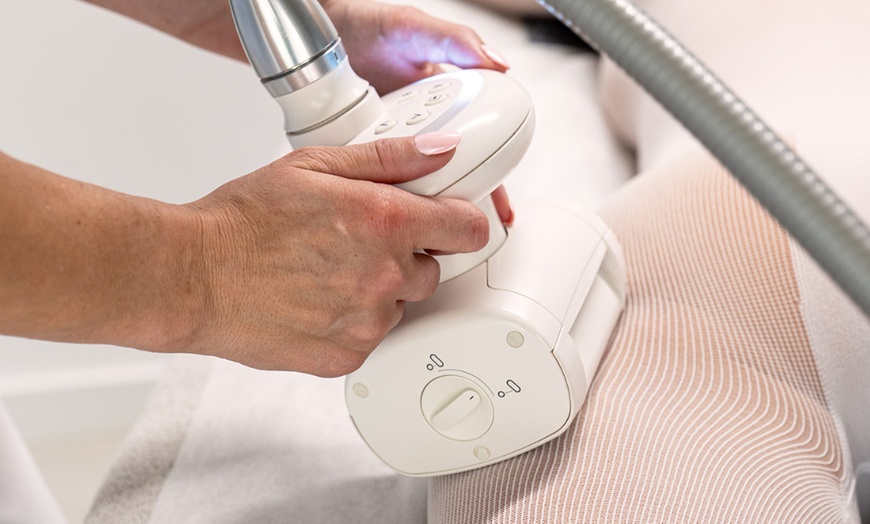 Image 1: Endermologia antycellulitowa LPG® Alliance: 1 lub 10 zabiegów